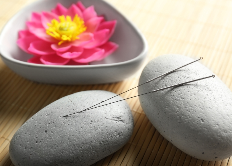 Acupuncture being used in cancer treatment
