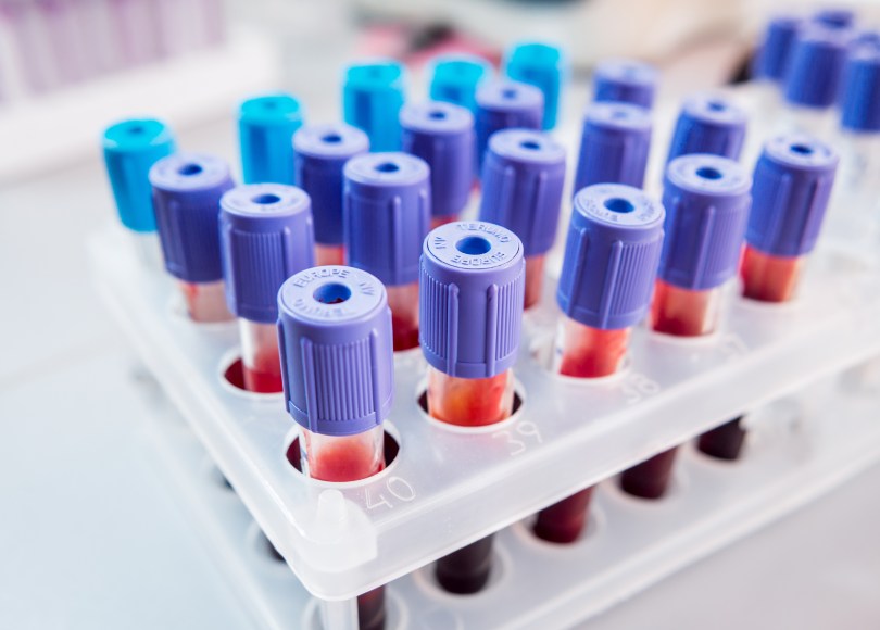 Blood samples that could potentially be used to screen for cancer